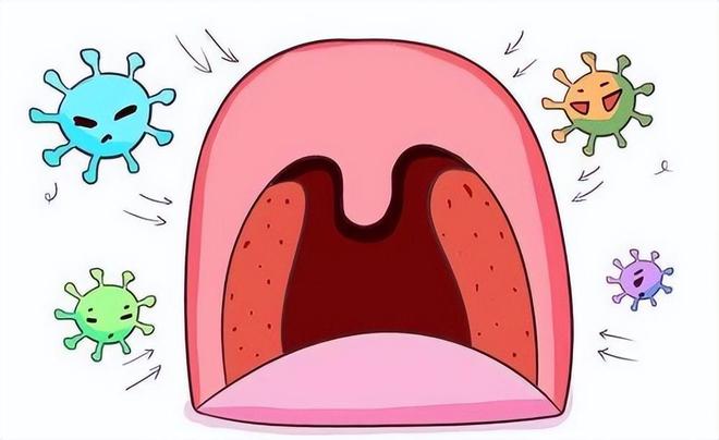 经常扁桃体发炎怎么办？这些原因都易引起发炎！出现永利app手机版官网症状及时就医(图5)