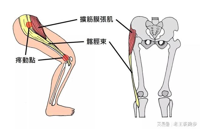 跑后必做永利app手机版官网的四个拉伸动作远离跑步膝！(图2)