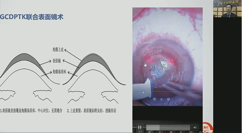 2021年眼科新进展协和高峰论坛（第二永利app手机版官网届）精彩回顾(图11)