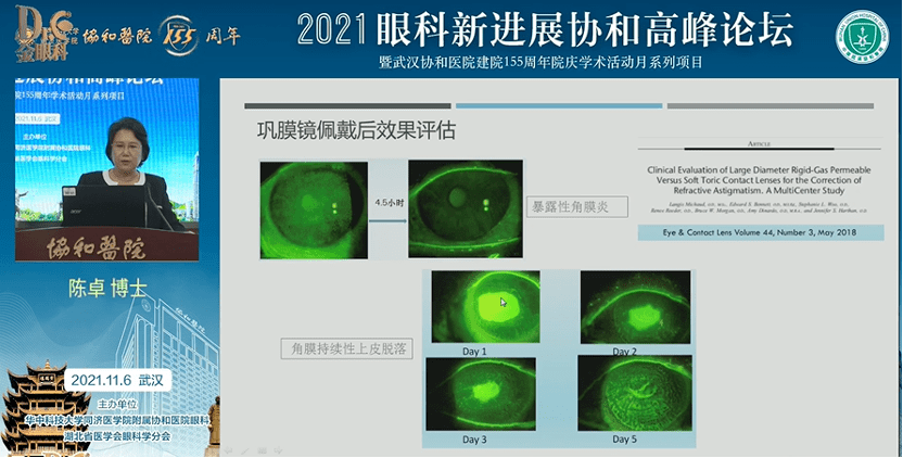 2021年眼科新进展协和高峰论坛（第二永利app手机版官网届）精彩回顾(图16)